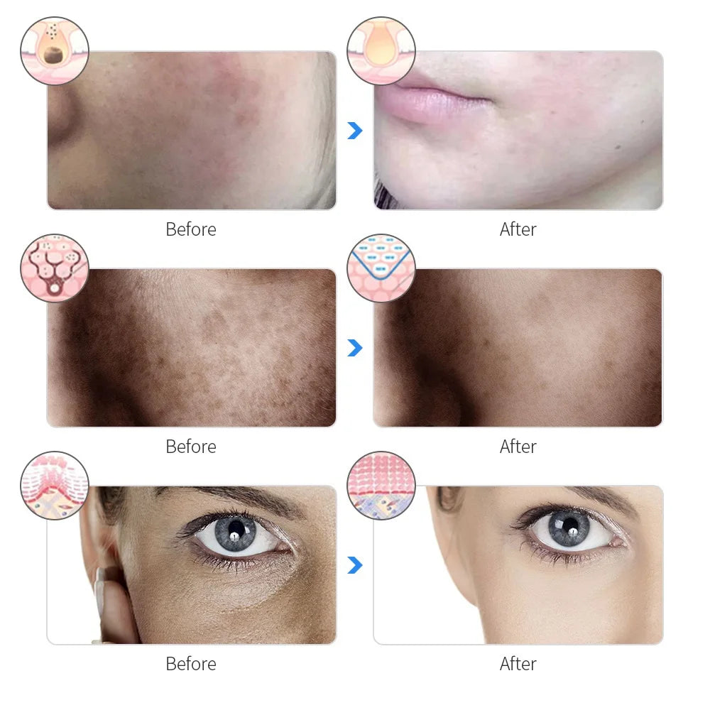 LumiGlow Pro - 7-in-1 LED Therapiemasker voor Professionele Huidverjonging